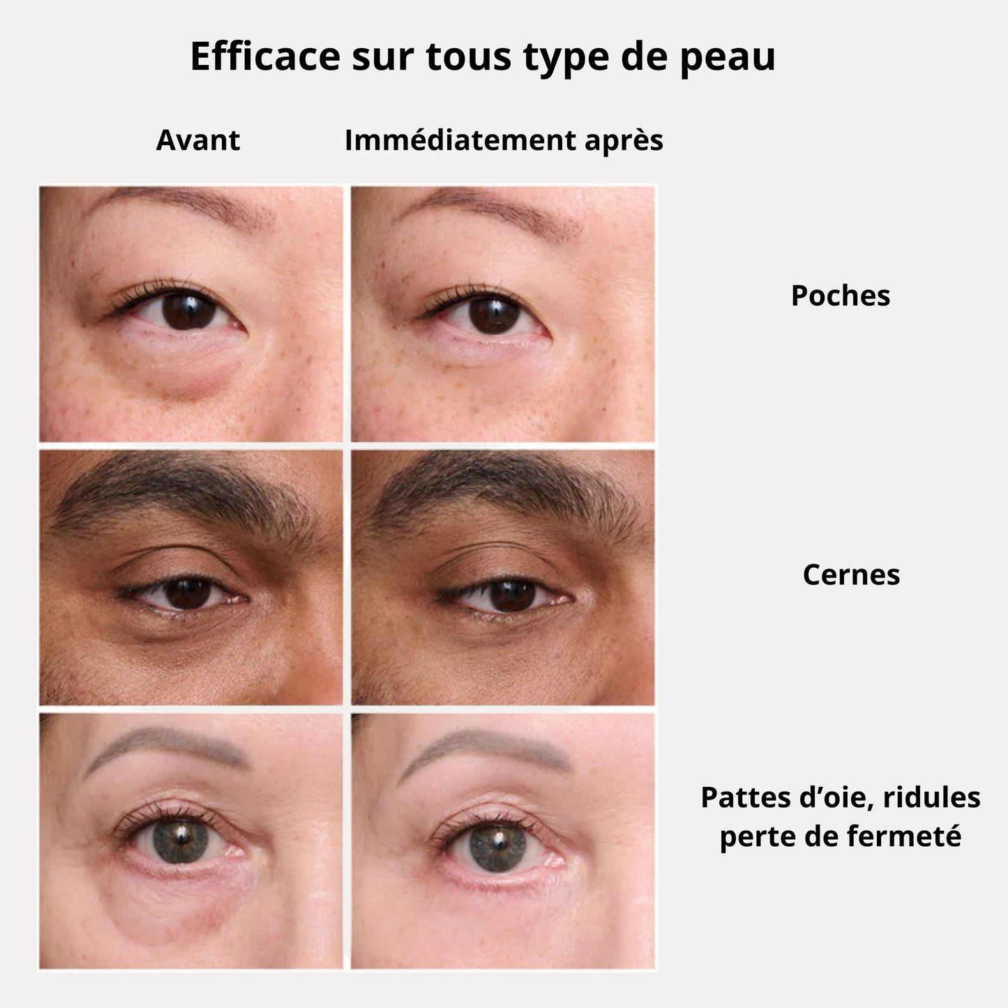 INSTANT GLOW - Lift instantané sans injection - 20 ml de magie