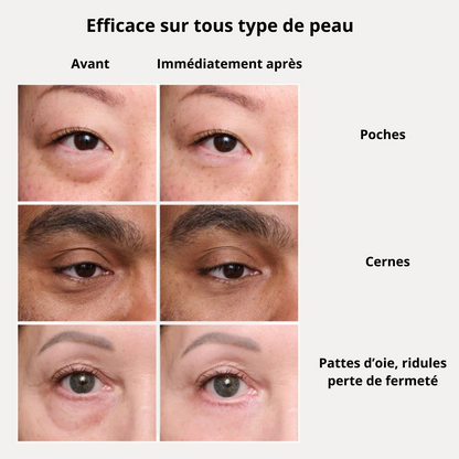 INSTANT GLOW - Lift instantané sans injection - 20 ml de magie